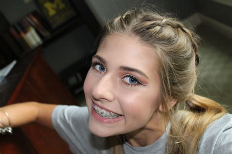 Braces girl : r/bracesgirlr